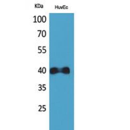 CXCR2 Antibody (1-50 aa, N-terminal)