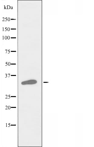 TROP2 / TACSTD2 Antibody