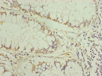TRIM31 / RNF Antibody