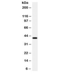 ADK / Adenosine Kinase Antibody