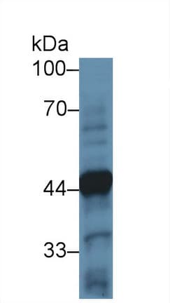 TH / Tyrosine Hydroxylase Antibody (aa34-301)