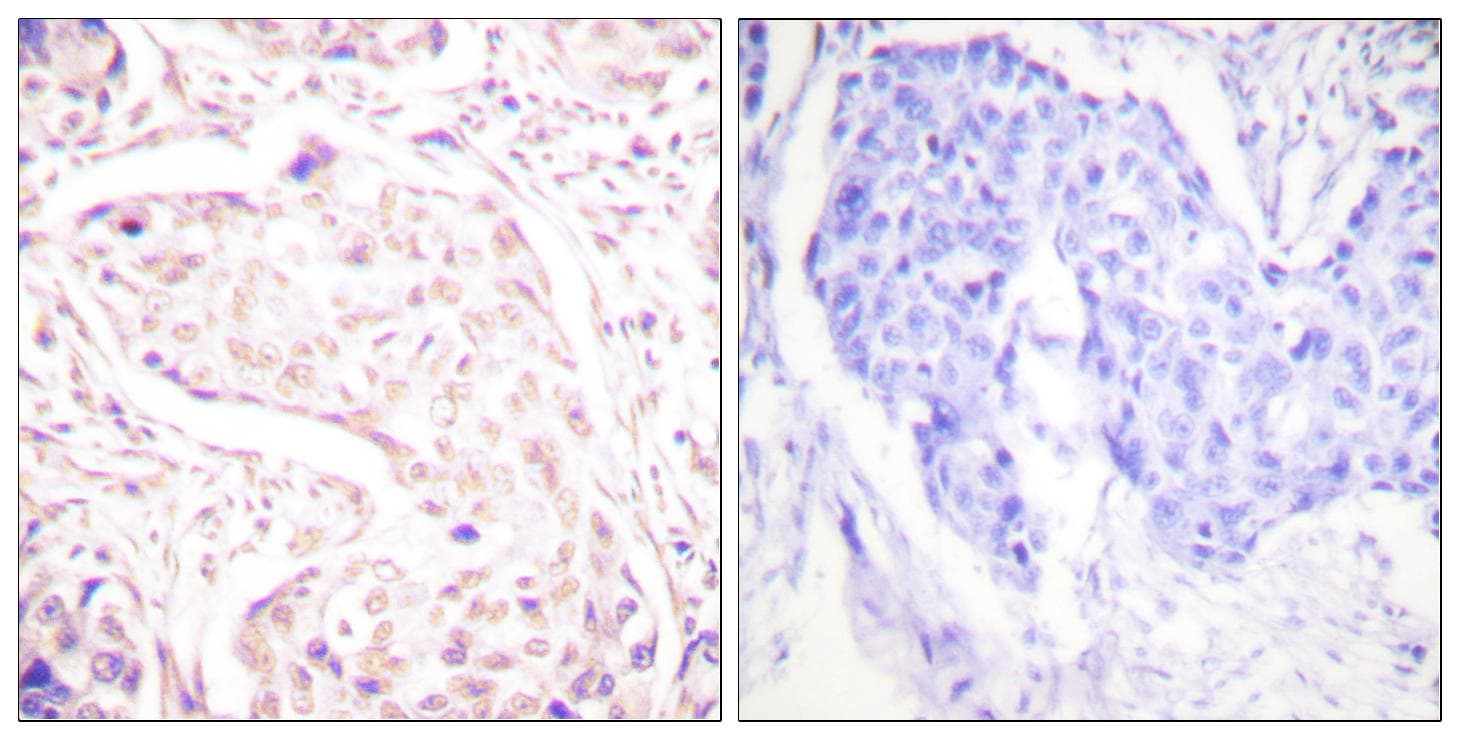 FOS / c-FOS Antibody (Ab-362)