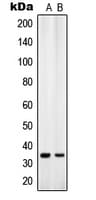 SLC25A31 Antibody (Internal)