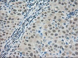 LDHA / LDH1 Antibody (clone OTI5G10)