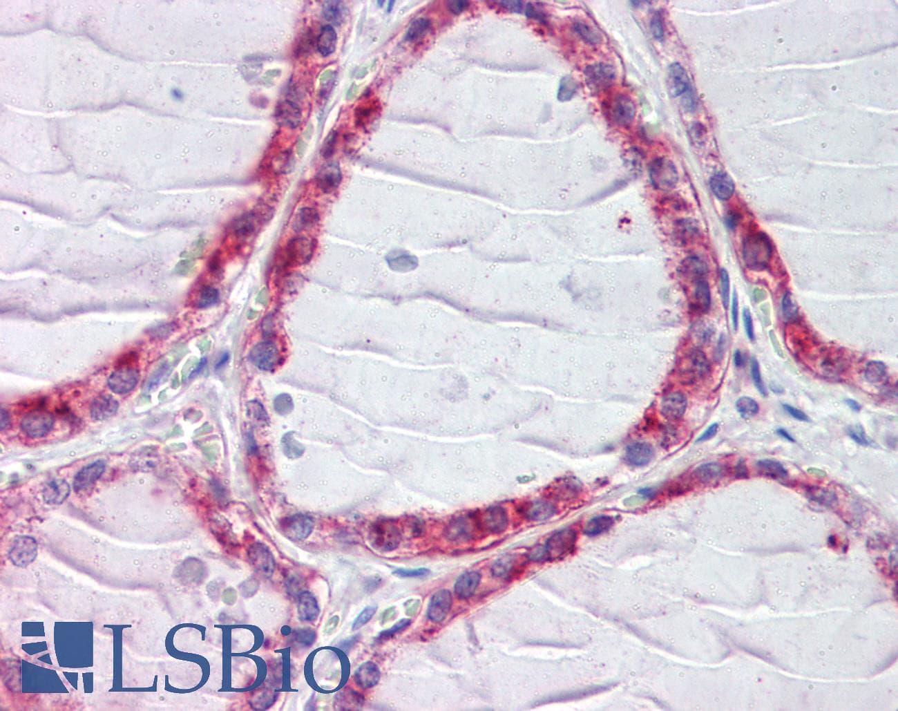 IHC-plus™ CLIP1 / CLIP-170 Antibody (aa1404-1417)