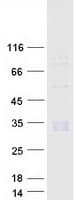 Human Complement C1QB Protein (Recombinant Myc-DDK (Flag))