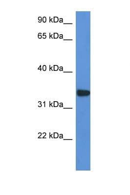 Polyclonal Rabbit anti-Human HCCS Antibody (aa194-243, WB)