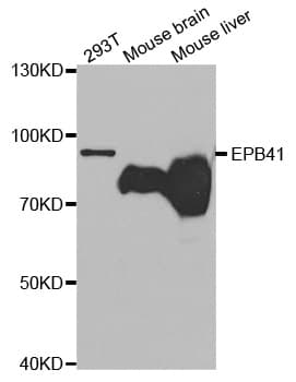 IHC-plus™ Band 4.1 / EPB41 Antibody