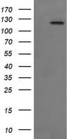 FAK / Focal Adhesion Kinase Antibody (clone OTI4A8)
