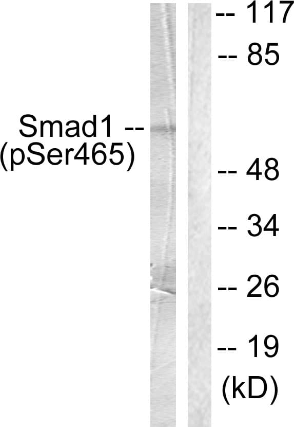 SMAD1 Antibody (phospho-Ser465)