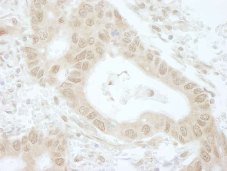 Polyclonal Rabbit anti-Human TIPRL / TIP Antibody (aa225-C-term, IHC)