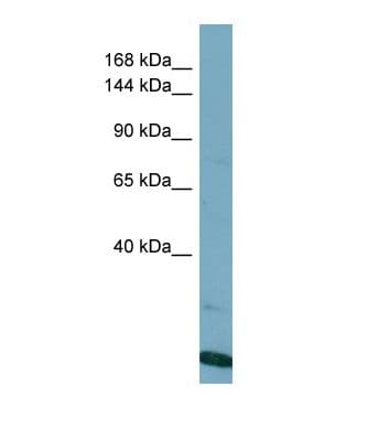VPS8 Antibody (aa34-83)