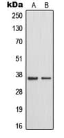 Polyclonal Rabbit anti-Human MAST4 Antibody (N-Terminus, IHC, IF, WB)