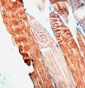 Monoclonal Mouse anti-Rabbit ACTN2 Antibody (clone 5C5, IHC)
