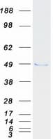 Human TADA3 / ADA3 Protein (Recombinant Myc-DDK (Flag))