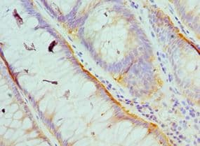 HCK Antibody (aa1-220)