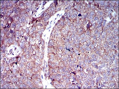 SLC2A4 / GLUT-4 Antibody (aa224-353, clone 3G10A3)