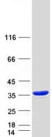 Human ACY3 Protein (Recombinant Myc-DDK (Flag))
