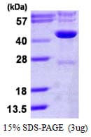 Human IDH3G Protein (Recombinant His)
