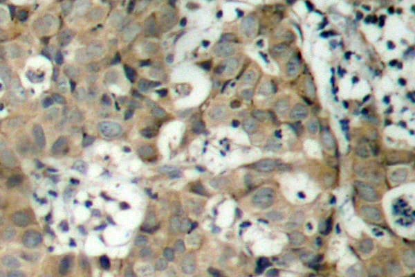 FOXO1 / FKHR Antibody (Phe313)