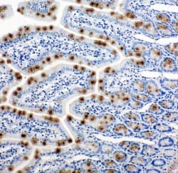 HSPH1 / HSP105 Antibody (aa713-733)