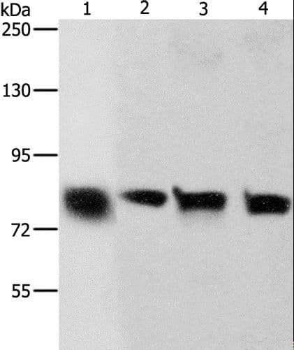Polyclonal Rabbit anti-Human CDH6 / K Cadherin Antibody (IHC, WB)