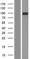 FES Protein (Over-Expression Lysate Myc-DDK (Flag))