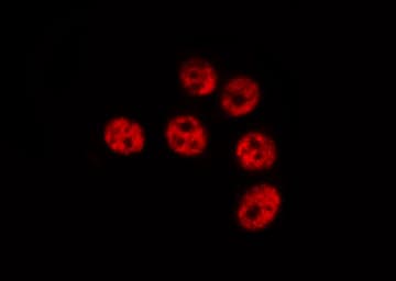 Polyclonal Rabbit anti-Human RELA / NFKB p65 Antibody (Acetyl-Lys310, IHC, IF, WB)