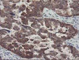 Monoclonal Mouse anti-Human DPH2 Antibody (clone OTI1A12, IHC, WB)