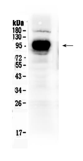 Polyclonal Rabbit anti-Human CD119 / IFNGR1 Antibody (WB)