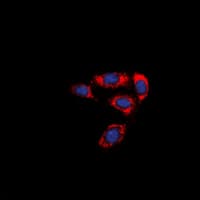 F2RL3 / PAR4 Antibody (Internal)