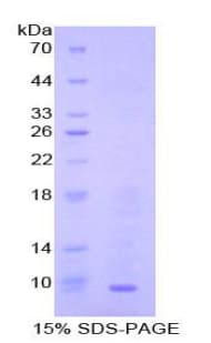 Mouse CCL22 / MDC Protein (Recombinant His)