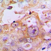 MYH7 Antibody