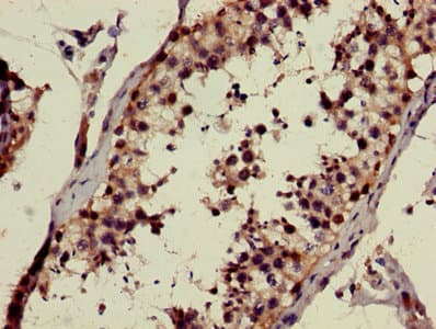 Polyclonal Rabbit anti-Human GALNAC4ST-2 / CHST9 Antibody (IHC, WB)