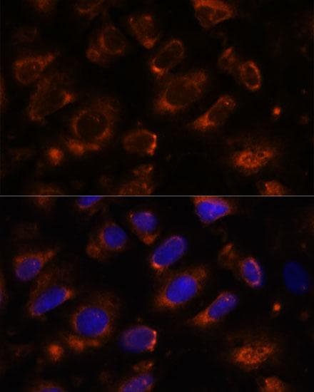 Polyclonal Rabbit anti-Human TNM / Teneurin-1 Antibody (IF, WB)
