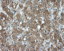 SRR / Serine Racemase Antibody (clone OTI3B5)