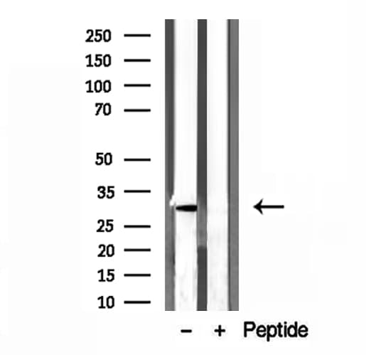 GNMT Antibody
