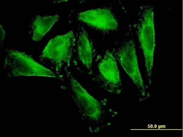 RFNG Antibody (clone 6C7)