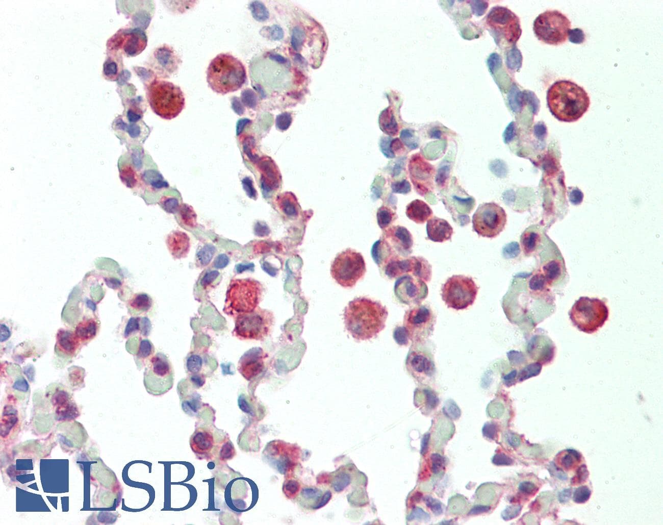IHC-plus™ Polyclonal Rabbit anti-Human PRKCDBP / CAVIN3 Antibody (C-Terminus, IHC, WB)