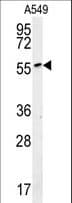 Polyclonal Rabbit anti-Human ALG10B Antibody (aa324-353, WB)