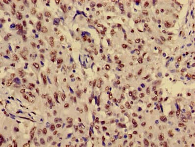 HIST1H3A Antibody