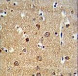 Polyclonal Rabbit anti-Human ADAM19 Antibody (aa207-236, IHC, WB)