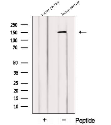 PRUNE2 Antibody