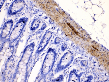 CHRNA5 Antibody