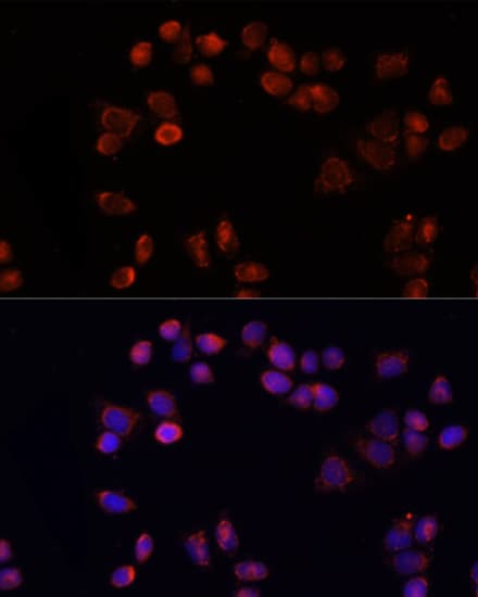 SLC25A4 / ANT Antibody