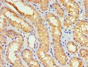 Polyclonal Rabbit anti-Human GBA3 / CBG Antibody (aa1-162, IHC, WB)