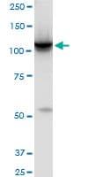 HK2 / Hexokinase 2 Antibody (clone 4H1)