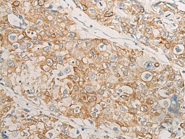Polyclonal Rabbit anti-Human HLA-DMB Antibody (IHC, WB)