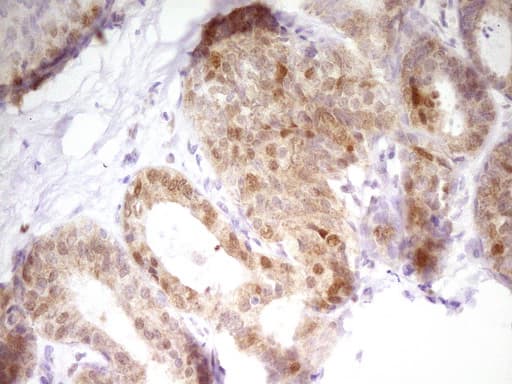 Monoclonal Mouse anti-Human PAPSS2 Antibody (clone OTI3H10, aa1-247, IHC, WB)