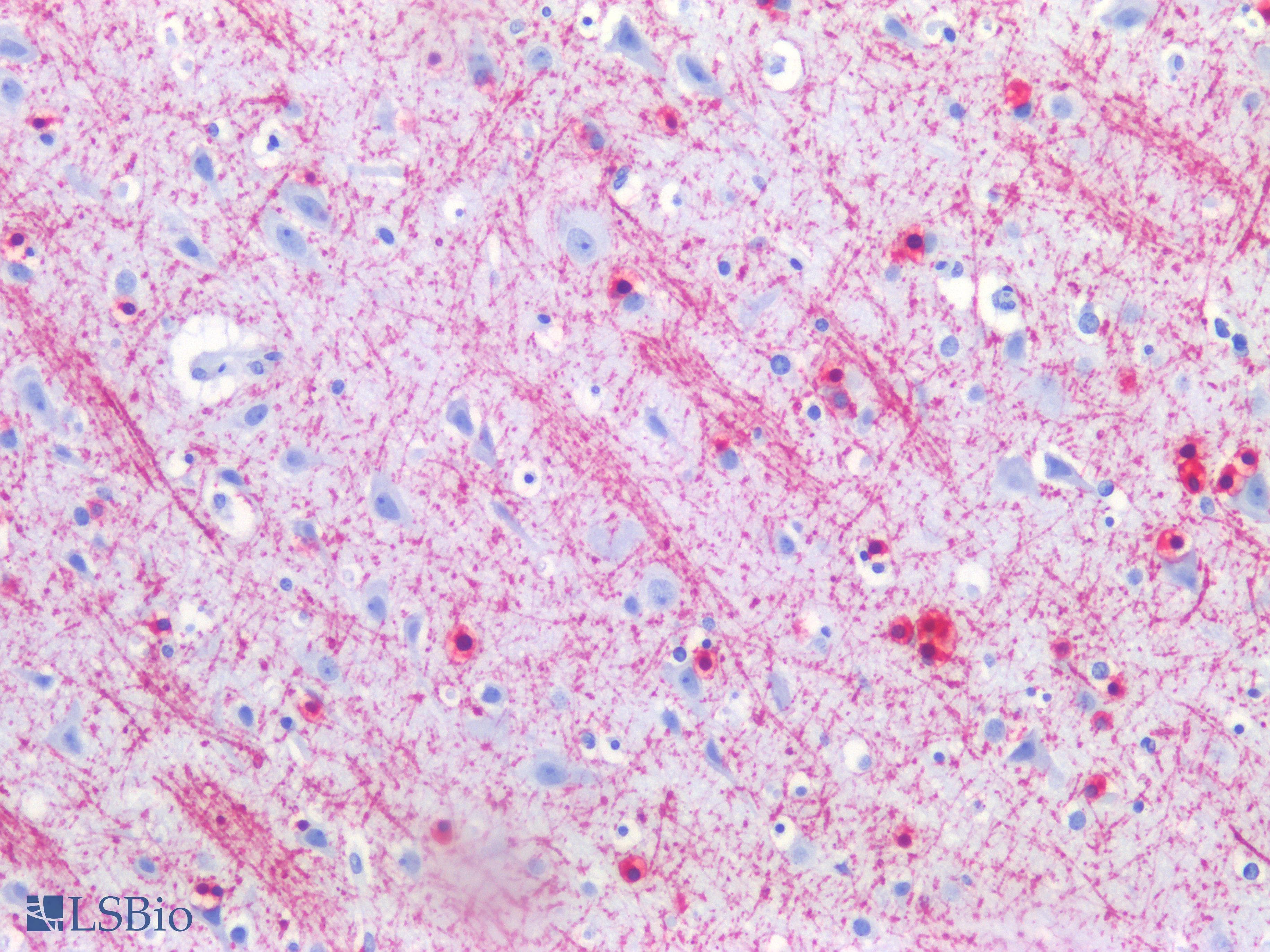 PathPlus™ MBP / Myelin Basic Protein Antibody (aa82-87, clone 12)